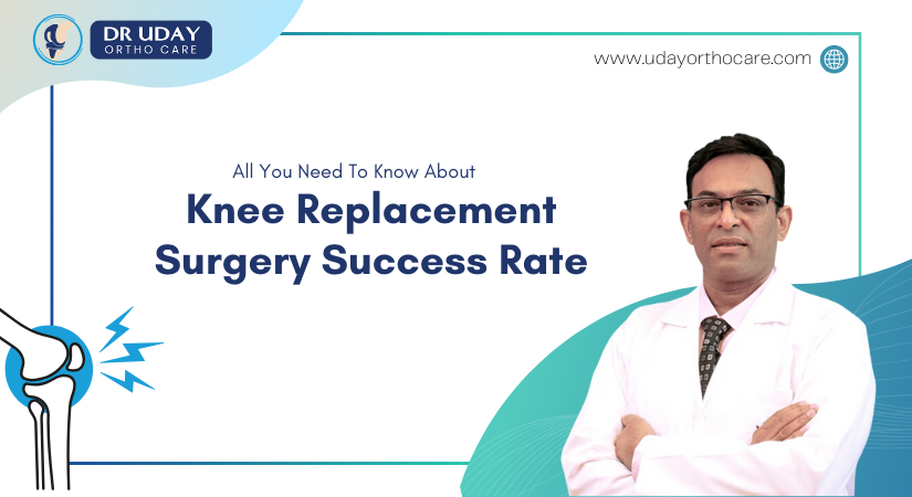 All You Need To Know About Knee Replacement Surgery Success Rate