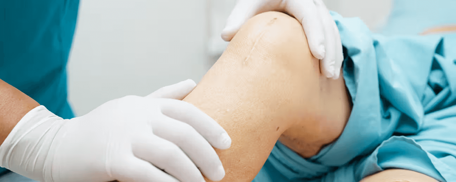 knee replacement surgery